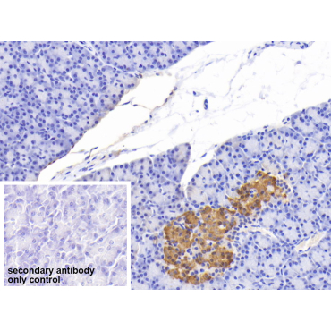 C-Peptide (CP) Human Polyclonal Antibody