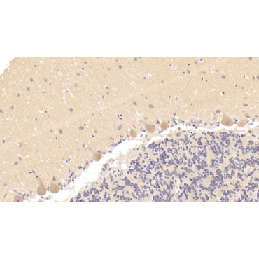 Caspase 7 (CASP7) Human Polyclonal Antibody