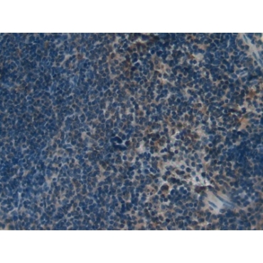 Kallikrein 4 (KLK4) Mouse Polyclonal Antibody