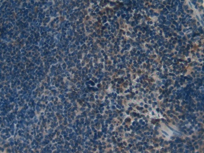 Kallikrein 4 (KLK4) Mouse Polyclonal Antibody