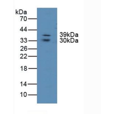 Lipase, Endothelial (LIPG) Human Polyclonal Antibody