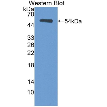 Heat Shock Transcription Factor 2 (HSF2) Human Polyclonal Antibody