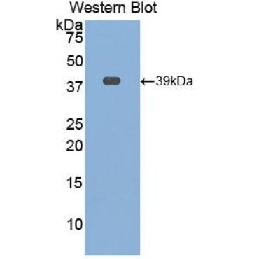 Osteocalcin (OC) Human Polyclonal Antibody