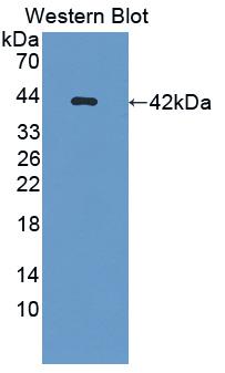 Osteocalcin (OC) Rabbit Polyclonal Antibody