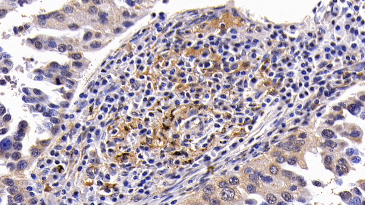 Calcitonin (CT) Pan-species (General) Polyclonal Antibody