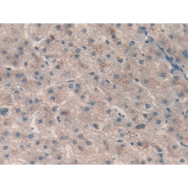 Calcitonin (CT) Human Polyclonal Antibody