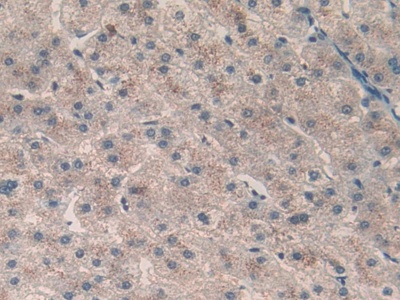 Calcitonin (CT) Human Polyclonal Antibody