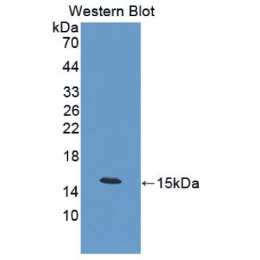 Calcitonin (CT) Mouse Polyclonal Antibody