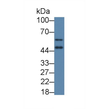 Vitamin D Receptor (VDR) Human Polyclonal Antibody