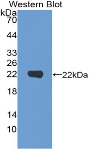 Vitamin D Receptor (VDR) Mouse Polyclonal Antibody