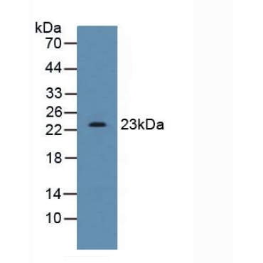 Stromal Cell Derived Factor 2 (SDF2) Human Polyclonal Antibody