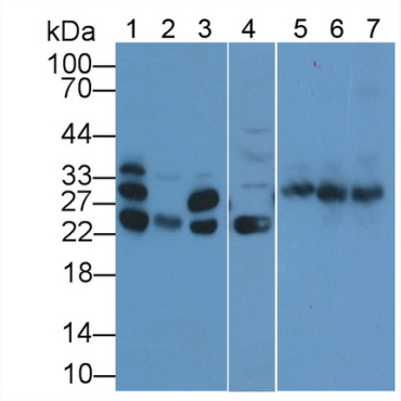 Cardiac Troponin I (cTnI) Human Polyclonal Antibody