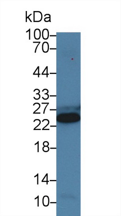 Cardiac Troponin I (cTnI) Pig Polyclonal Antibody