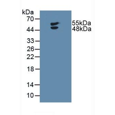 Lymphotoxin Beta Receptor (LTbR) Human Polyclonal Antibody
