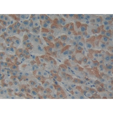 Endothelin 1 (EDN1) Human Polyclonal Antibody