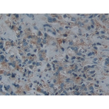 Endothelin Converting Enzyme 1 (ECE1) Human Polyclonal Antibody