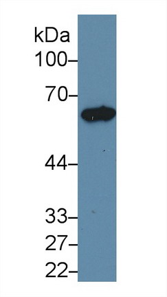 Cytokeratin 5 (CK5) Rat Polyclonal Antibody