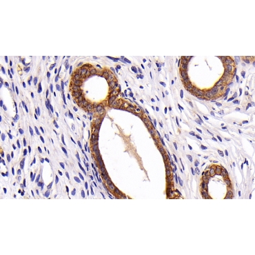 Keratin 3 (KRT3) Human Polyclonal Antibody