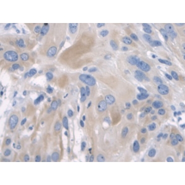 Keratin 2 (CK2) Human Polyclonal Antibody