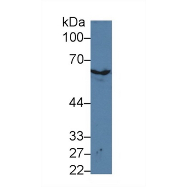 Keratin 2 (CK2) Mouse Polyclonal Antibody