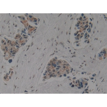 Cytokeratin 1 (CK1) Human Polyclonal Antibody