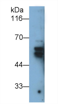 Cytokeratin 1 (CK1) Rat Polyclonal Antibody