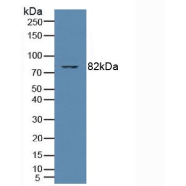 Protein Kinase C Theta (PKCq) Human Polyclonal Antibody