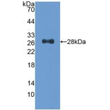 Cyclin Dependent Kinase 9 (CDK9) Human Polyclonal Antibody