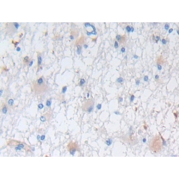 Nestin (NES) Human Polyclonal Antibody