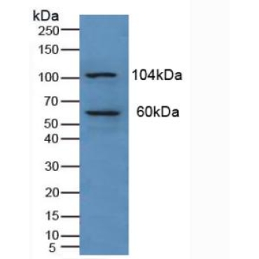 Protein Kinase N1 (PKN1) Human Polyclonal Antibody