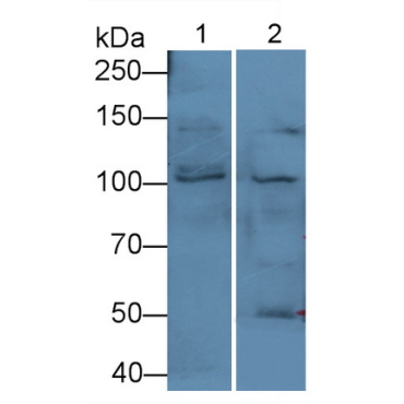 Protein Kinase D1 (PKD1) Human Polyclonal Antibody