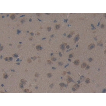Protein Kinase D1 (PKD1) Mouse Polyclonal Antibody