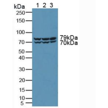 Protein Kinase D2 (PKD2) Human Polyclonal Antibody