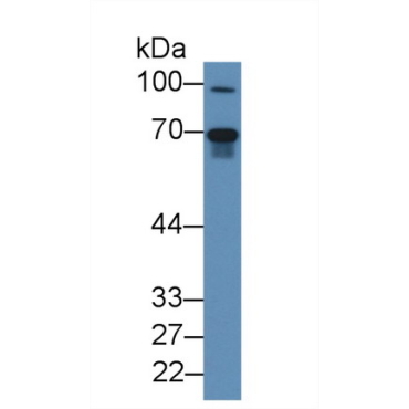 Fibrinogen Like Protein 2 (FGL2) Human Polyclonal Antibody