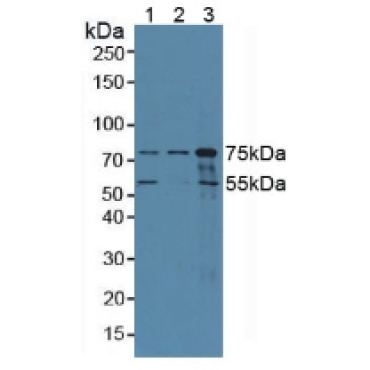 Coilin (COIL) Human Polyclonal Antibody