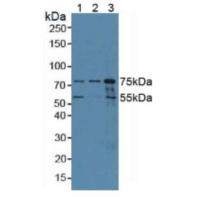 Coilin (COIL) Human Polyclonal Antibody