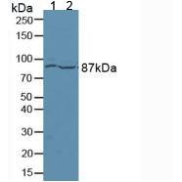 Ataxin 1 (ATXN1) Human Polyclonal Antibody