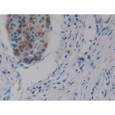 Serum Response Factor (SRF) Human Polyclonal Antibody