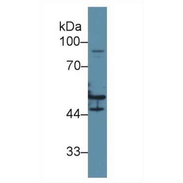 Cytokeratin 16 (CK16) Human Polyclonal Antibody