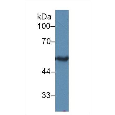 Cytokeratin 15 (CK15) Human Polyclonal Antibody