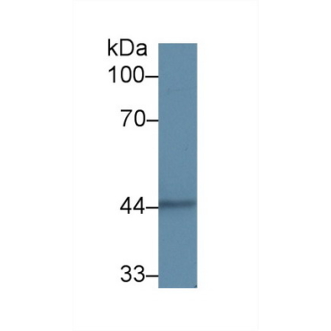 Cytokeratin 15 (CK15) Human Polyclonal Antibody