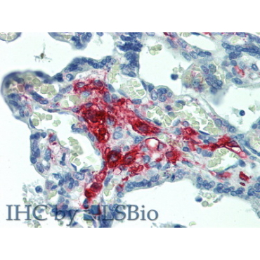 Ferritin (FE) Human Polyclonal Antibody