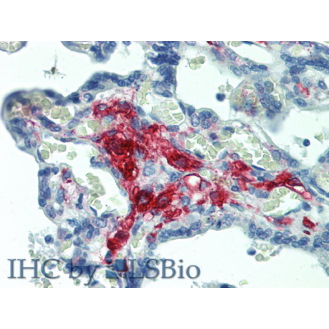 Ferritin (FE) Human Polyclonal Antibody