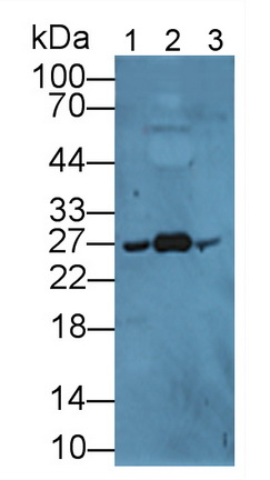 Apolipoprotein A1 (APOA1) Rabbit Polyclonal Antibody