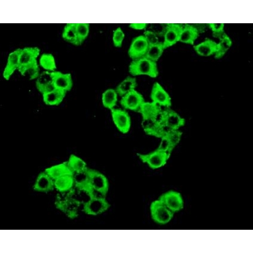 Protein Kinase R (PKR) Human Polyclonal Antibody