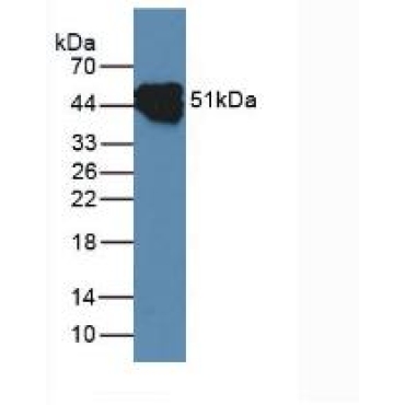 Cytokeratin 14 (CK14) Human Polyclonal Antibody