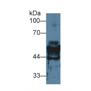 Cytokeratin 14 (CK14) Mouse Polyclonal Antibody