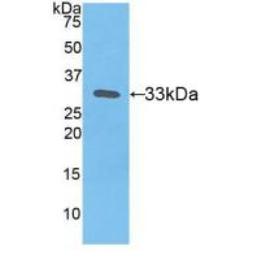 Tissue Factor (TF) Human Polyclonal Antibody