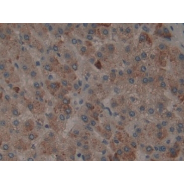 Tissue Plasminogen Activator (tPA) Human Polyclonal Antibody