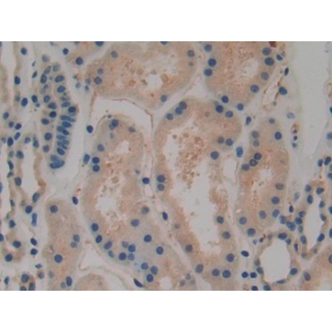 Tissue Plasminogen Activator (tPA) Human Polyclonal Antibody